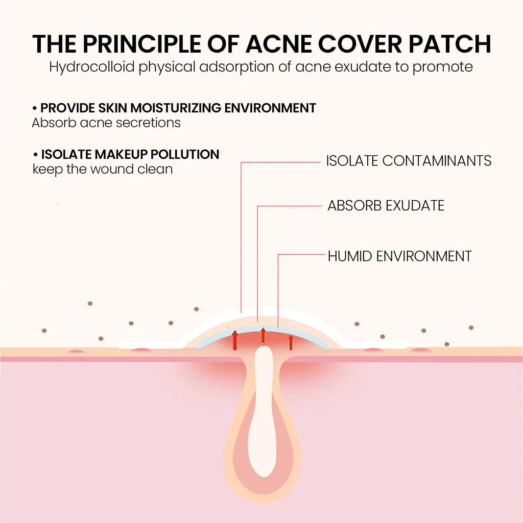 Patches de Estrela para Acne – Adesivos Faciais Ultra Finos.